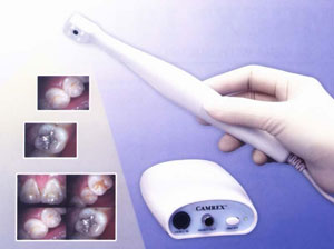 Intraoral Camera